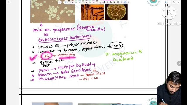 Mycology pyq images #fmge #inicet #neetpg #medicine #upsccms #upsccms #fmgerecall смотреть онлайн