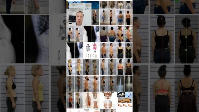 Онемение и боль | Как избавиться на долгие годы! #доктор #медицина #позвоночник смотреть онлайн