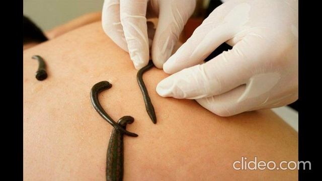Метод Абуладзе смотреть онлайн