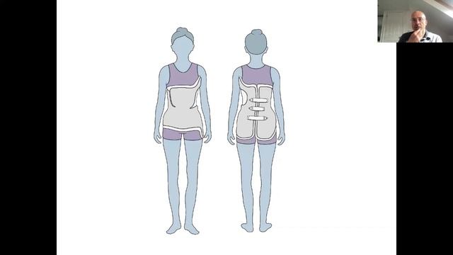 Medical Considerations in Children with SCI - Growing with Spinal Cord Injury Webinar смотреть онлайн