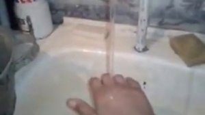 как легко сломать палец