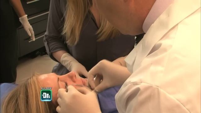 Removing Varicose Veins Under Eyes -- The Doctors