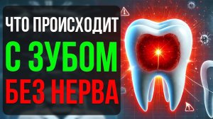 Болит Зуб От Пульпита! Как Распознать и Вылечить?