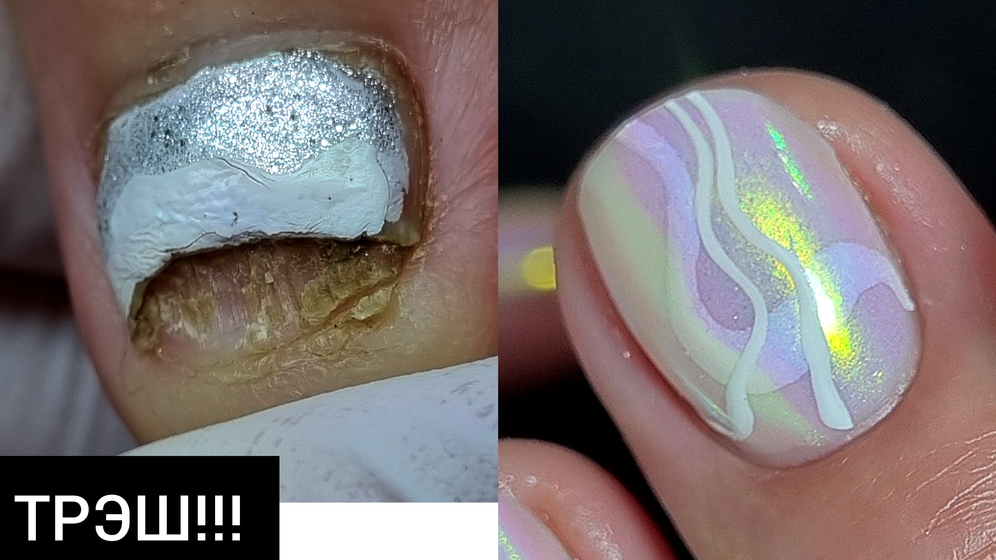 УЖАС!! что у нее С НОГТЕМ