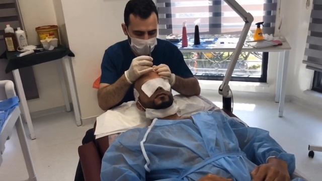 Euro pro hair clinic || تجربة احد العملاء بتغطية 5120 بصيلة смотреть онлайн