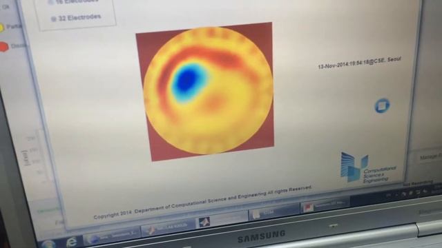 Real-monitoring software by Integrating SWISSTOM EIT-Pioneer Set with MATLAB GUI смотреть онлайн