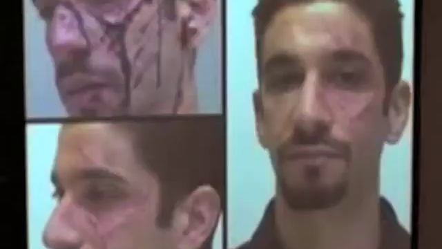 Why I Bleed . . . (from 