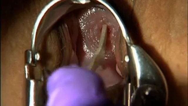 Pelvic Examination смотреть онлайн