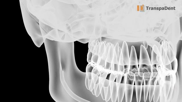 Шаблон мини импланта смотреть онлайн