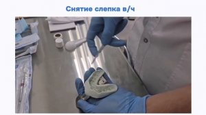 С-силикон (двойной оттиск в/ч и н/ч)