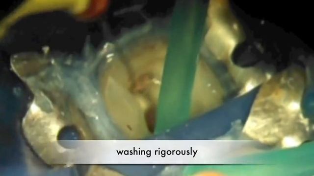 Dental Reconstruction