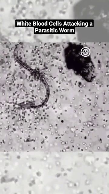 White Blood Cells Attacking a Parasitic Worm смотреть онлайн