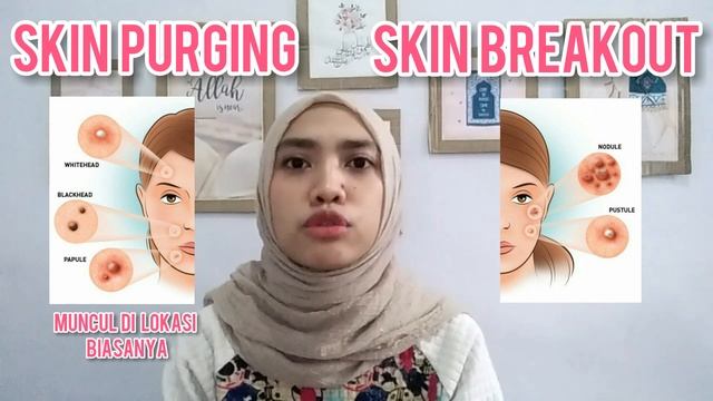 INI TANDANYA SKINCARE KALIAN GAK COCOK! PURGING ATAU BREAKOUT? | RIFF'S VLOG