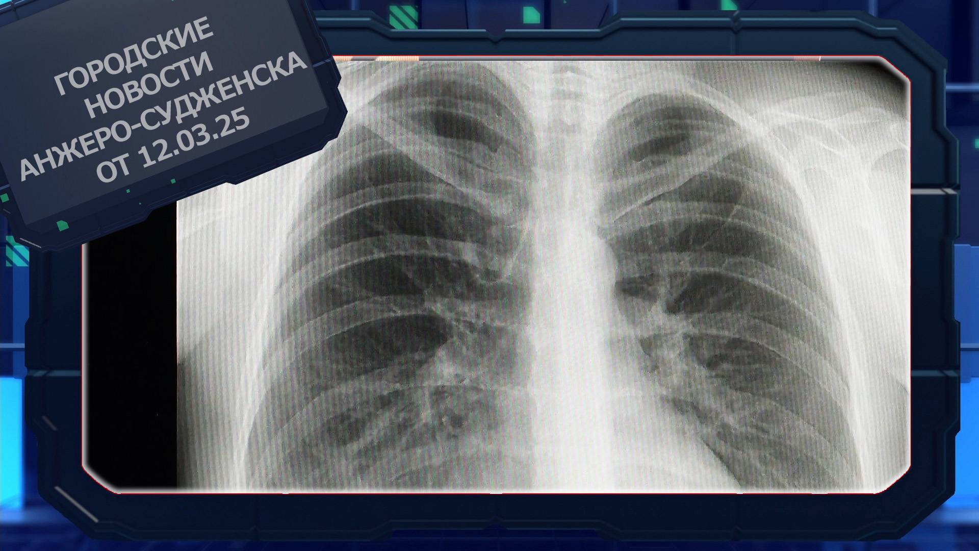 Городские новости Анжеро-Судженска от 12.03.25 смотреть онлайн