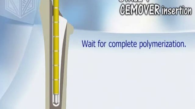 OP-Technik: Metal Cemover powered by Tecres смотреть онлайн