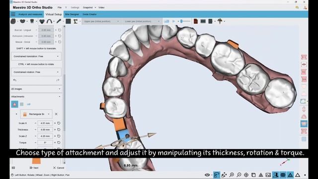 Maestro 3D | Dental Studio | User Video Tutorials | Come aggiungere un Ponte Virtuale смотреть онлайн