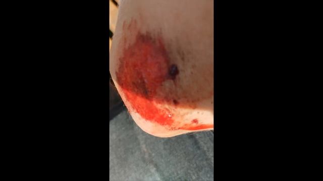 дроп в вытегре смотреть онлайн