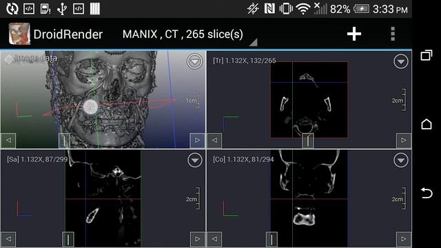 DroidRender : Basic operations смотреть онлайн