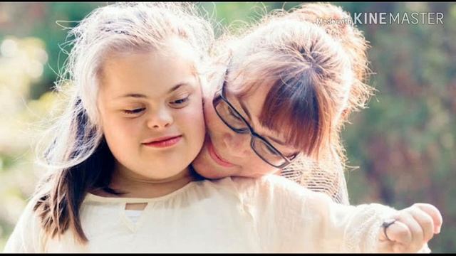 What Is Down Syndrome | In Urdu / Hindi смотреть онлайн