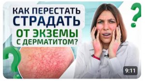 Дерматит, Экзема = 1 простое лечение! Как помочь своей коже