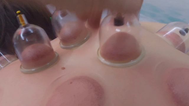 вакуумная коррекция фигуры смотреть онлайн