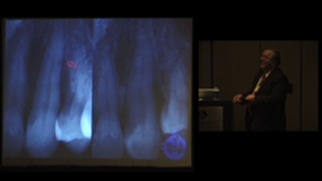 Phil Sukel, DDS & Dave Regiani, DDS: The Use of Lasers to Improve Gum Conditions IAOMT Chicago 2008 смотреть онлайн