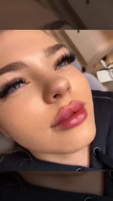 Косметолог спб🎁Ⓜ️inst: Vmed.cosmetologspb смотреть онлайн