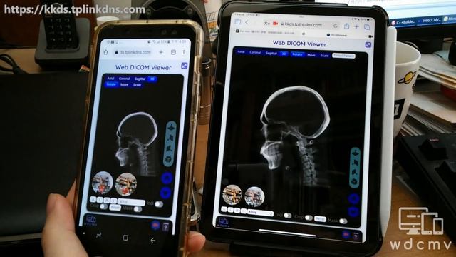 Using Web DICOM Viewer on iPad and Android phone (short version) смотреть онлайн