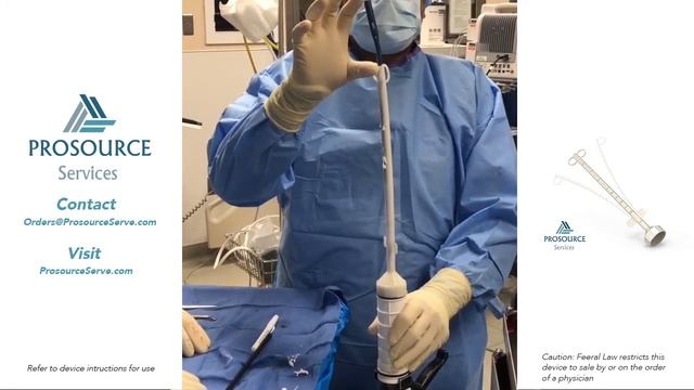 Prosource Services Antibiotic Cement Nail Mold смотреть онлайн