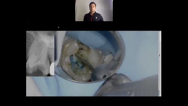 COVID ENDO Webinar #3 - Operatory Setup and Access смотреть онлайн