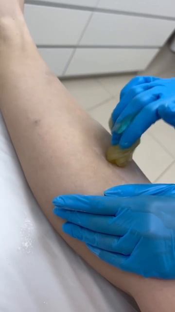 Шугаринг в Epil Story 🍯
#лазернаяэпиляция #депиляция #электроэпиляция #косметология смотреть онлайн