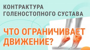 🧐🦶 Контрактура голеностопного сустава, что ограничивает движение?