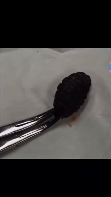 Cat Rescue | Botfly Larva Removed From Cats *3 #shorts #wildlife #rescuecat #wildanimals смотреть онлайн