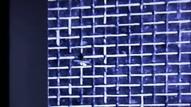 Targeted Individual lost eyesight by military radar, Microwave смотреть онлайн