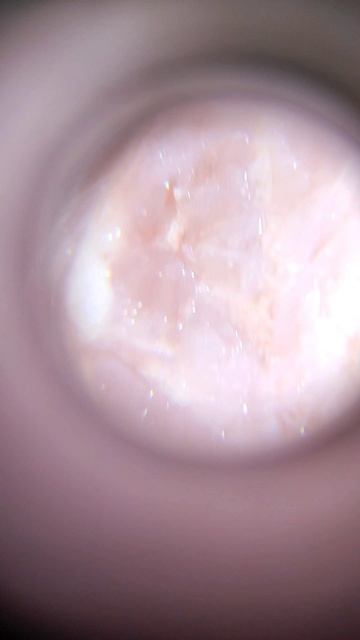 Жуткий БЕКОН под МИКРОСКОПОМ😳 #шок #жесть #микроскоп #подмикроскопом #бекон #yummy