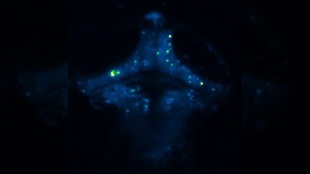 2-photon lightsheet calcium imaging in larval zebrafish смотреть онлайн