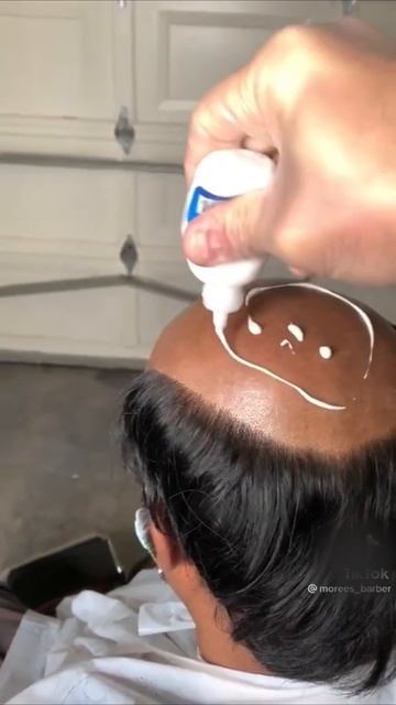 Метод маскировки облысения с помощью накладных волос. Минусы! смотреть онлайн