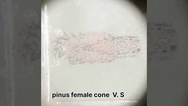 botany spotting part 2 pteridophyta and gymnosperm spotting slide view under microscope🔬#youtube смотреть онлайн