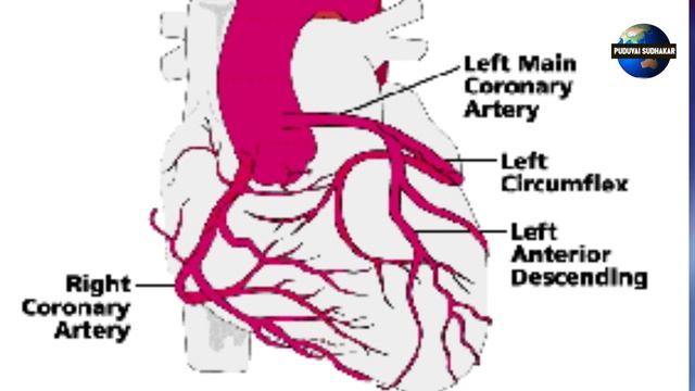 ANGIOGRAM IN TAMIL | ANGIOPLASTY IN TAMIL | ANGIOGRAPHY IN TAMIL | HEART ATTACK | TREATMENT OF HEAR