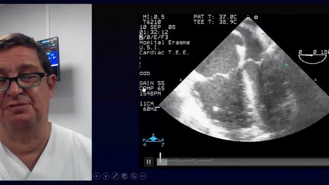Ultrasound in Hemodynamic Management Daniel De Backer 2021