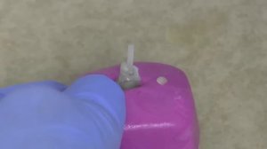 Cementing a Rely-X Fiber Post with Unicem Cement