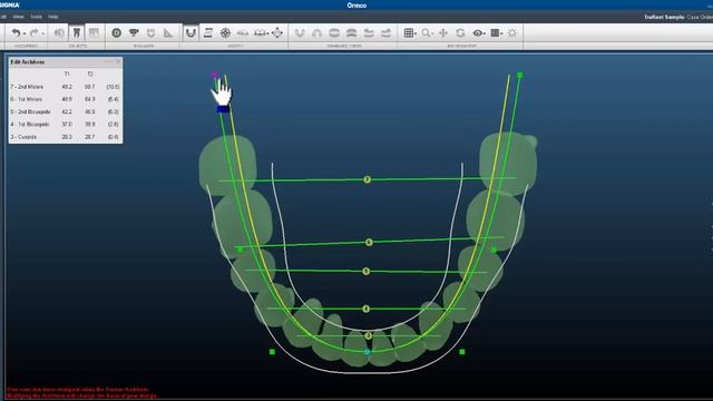 Arch form смотреть онлайн