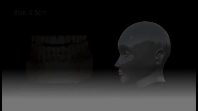 Vatech Ez-3D-i, logiciel de planification implantaire смотреть онлайн