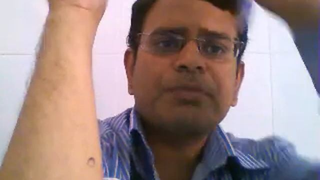 Koebner's Phenomenon