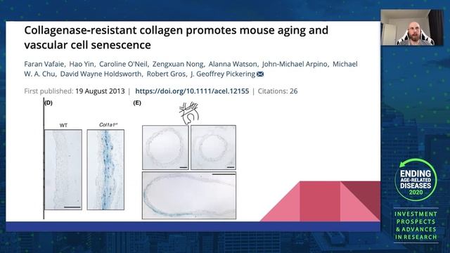Alexander Fedintsev | Collagen Glycation: Beyond Vascular Stiffness and Hypertension смотреть онлайн