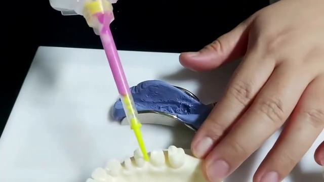 Использование оттискных масс линейки  I-Sil