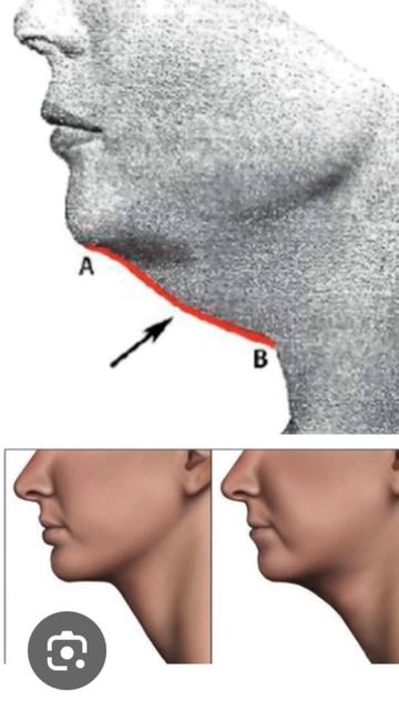 #шея #упражнения #фитнес смотреть онлайн