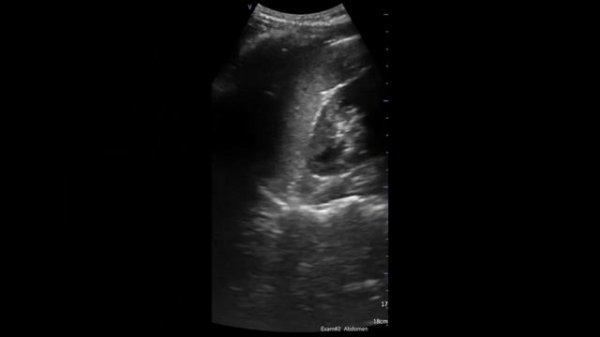 GE VScan Air Review - 4 practitioners' view!