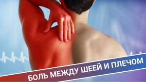 БОЛЬ МЕЖДУ ШЕЕЙ И ПЛЕЧОМ