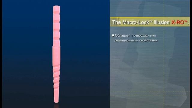 Macro-lock post X-RO illusion - 10 смотреть онлайн